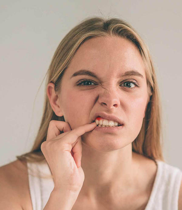 Symptoms of Gum Disease in Spring, TX
