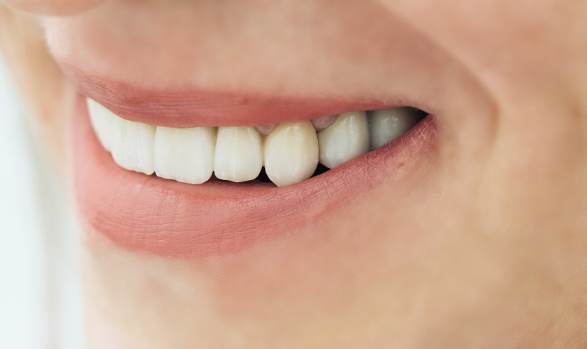 Dentures & Bridges Spring - Vibe Dentistry
