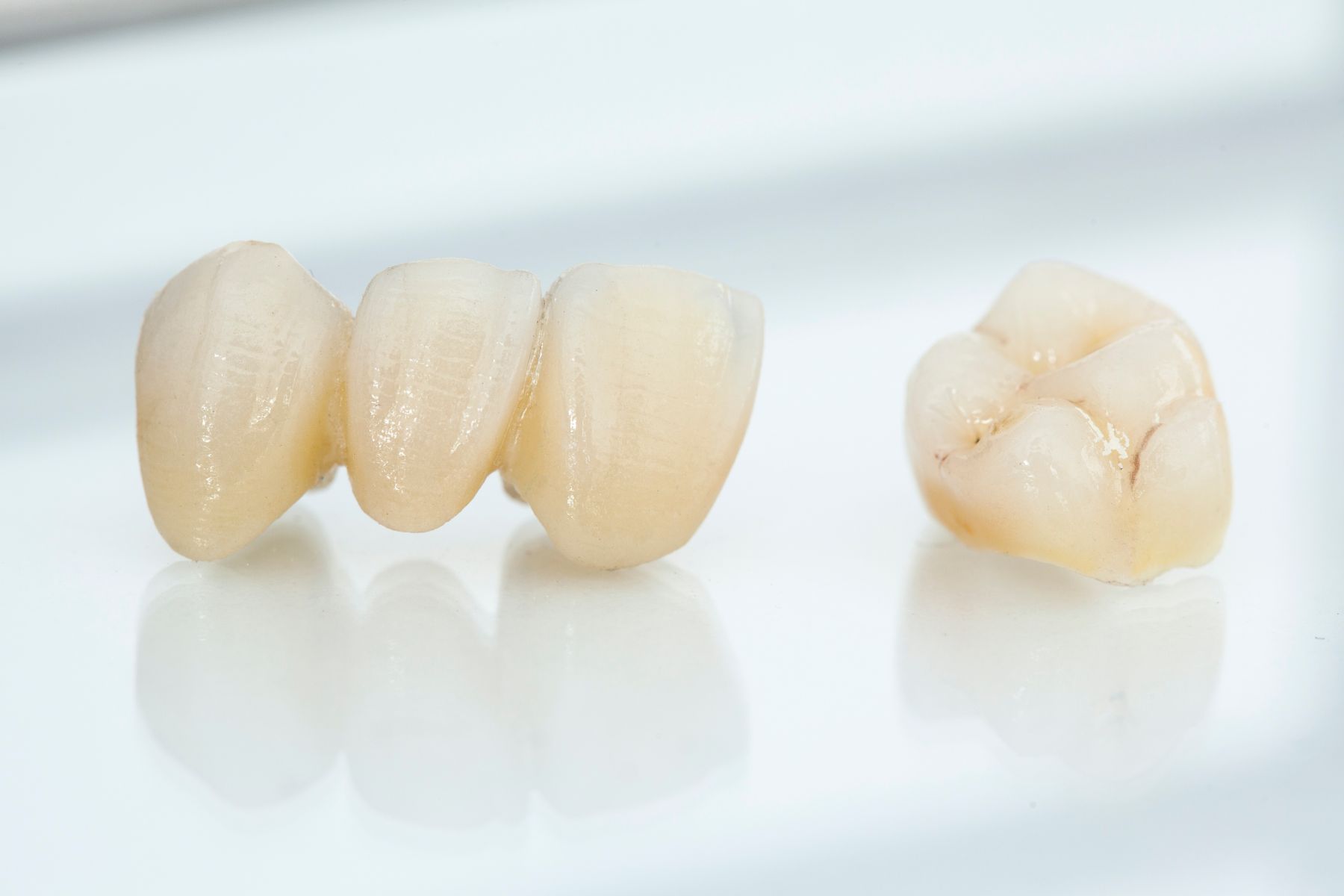 Dental Crowns Spring