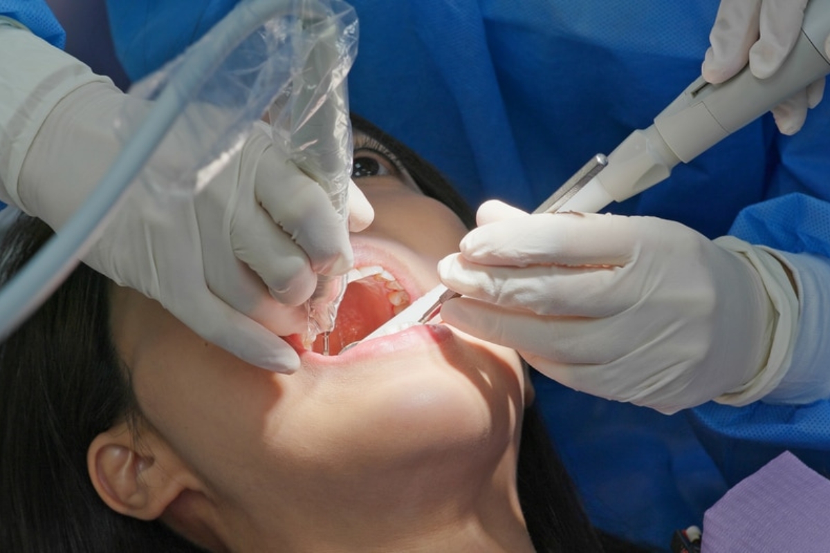 Root Canal Treatment Spring