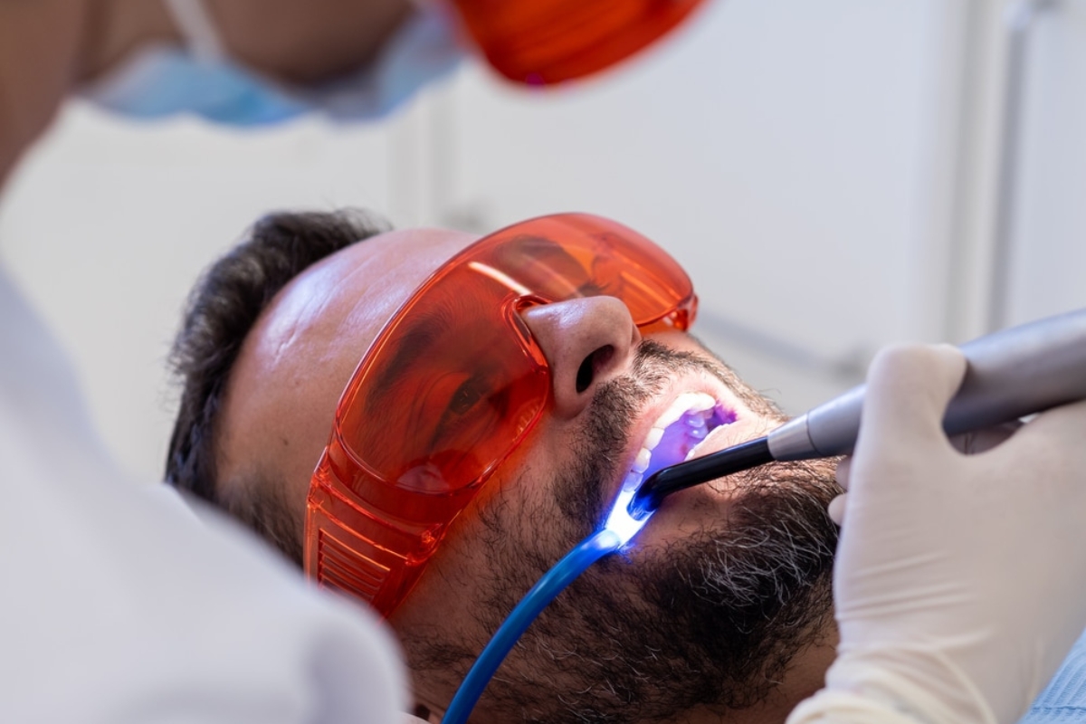 Teeth Whitening