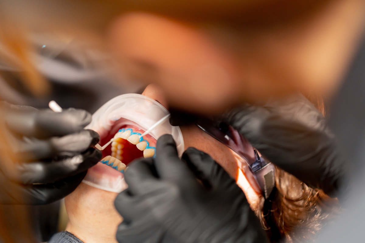 Teeth Whitening Spring
