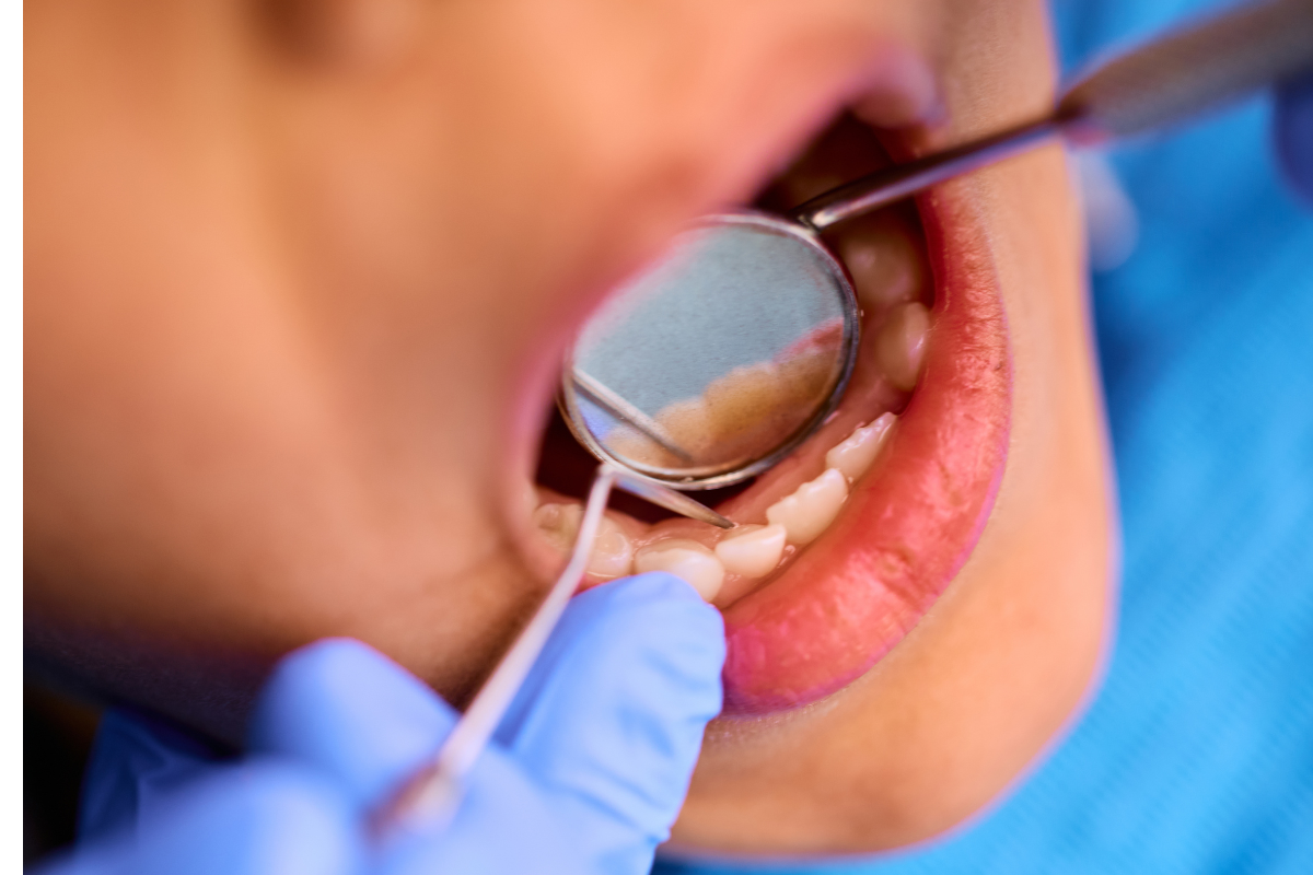 Dentist in Spring TX