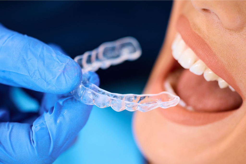 invisalign in Spring TX