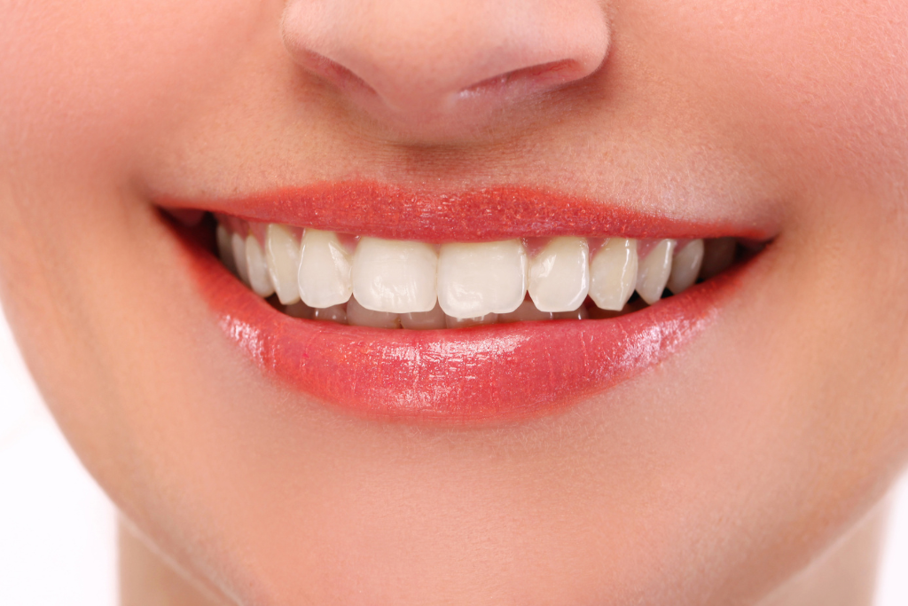 Patient showing off a restored smile after receiving cosmetic bonding Spring